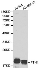 FTH1 / Ferritin Heavy Chain Antibody - Western blot of FTH1 pAb in extracts from Jurkat and SH-SY-5Y cells.