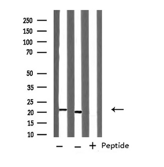 FTH1 / Ferritin Heavy Chain Antibody - Western blot analysis of FTH1 expression in various lysates