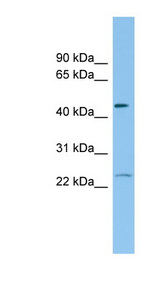FTH1 / Ferritin Heavy Chain Antibody - FTH1 antibody Western blot of HCT15 cell lysate. This image was taken for the unconjugated form of this product. Other forms have not been tested.