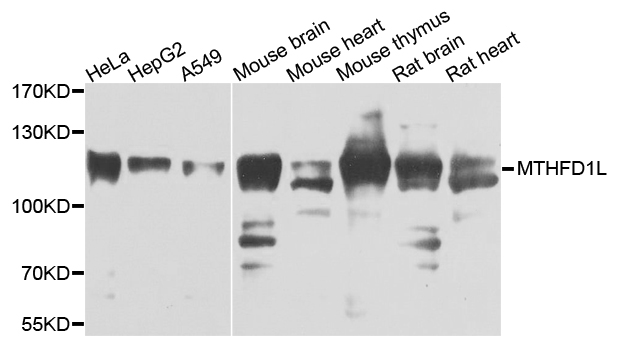 FTHFSDC1 / MTHFD1L Antibody - Western blot analysis of extracts of various cells.