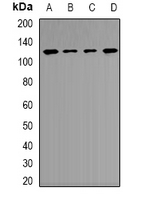 FTHFSDC1 / MTHFD1L Antibody - Western blot analysis of MTHFD1L expression in HepG2 (A); A549 (B); mouse brain (C); rat heart (D) whole cell lysates.