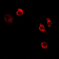 FTHFSDC1 / MTHFD1L Antibody - Immunofluorescent analysis of MTHFD1L staining in A549 cells. Formalin-fixed cells were permeabilized with 0.1% Triton X-100 in TBS for 5-10 minutes and blocked with 3% BSA-PBS for 30 minutes at room temperature. Cells were probed with the primary antibody in 3% BSA-PBS and incubated overnight at 4 deg C in a humidified chamber. Cells were washed with PBST and incubated with a DyLight 594-conjugated secondary antibody (red) in PBS at room temperature in the dark.