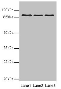 FTHFSDC1 / MTHFD1L Antibody - Western blot All Lanes: MTHFD1L antibody at 3.68ug/ml Lane 1: Colo320 whole cell lysate Lane 2: HepG-2 whole cell lysate Lane 3: Hela whole cell lysate Secondary Goat polyclonal to Rabbit IgG at 1/10000 dilution Predicted band size: 106,30 kDa Observed band size: 106 kDa