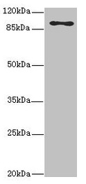 FTHFSDC1 / MTHFD1L Antibody - Western blot All lanes: MTHFD1L antibody at 3.68µg/ml + Hela whole cell lysate Secondary Goat polyclonal to rabbit IgG at 1/10000 dilution Predicted band size: 106, 30 kDa Observed band size: 106 kDa
