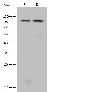 FTHFSDC1 / MTHFD1L Antibody - Anti-MTHFD1L rabbit polyclonal antibody at 1:500 dilution. Lane A: Hela Whole Cell Lysate. Lane B: NIH-3T3 Whole Cell Lysate. Lysates/proteins at 30 ug per lane. Secondary: Goat Anti-Rabbit IgG (H+L)/HRP at 1/10000 dilution. Developed using the ECL technique. Performed under reducing conditions. Predicted band size: 106 kDa.