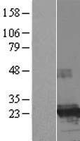 FTHL17 Protein - Western validation with an anti-DDK antibody * L: Control HEK293 lysate R: Over-expression lysate