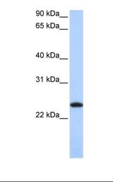 FTL / Ferritin Light Chain Antibody - HepG2 cell lysate. Antibody concentration: 1.0 ug/ml. Gel concentration: 12%.  This image was taken for the unconjugated form of this product. Other forms have not been tested.