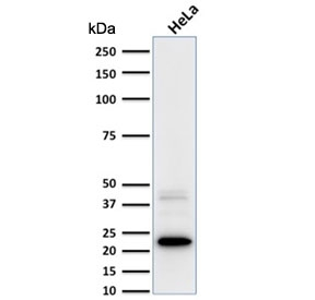 FTL / Ferritin Light Chain Antibody - Western blot testing of human HeLa cell lysate with FTL antibody. Predicted molecular weight ~20 kDa.