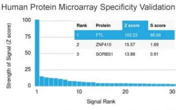 FTL / Ferritin Light Chain Antibody - Analysis of HuProt(TM) microarray containing more than 19,000 full-length human proteins using FTL antibody. These results demonstrate the foremost specificity of the FTL/1387 mAb. Z- and S- score: The Z-score represents the strength of a signal that an antibody (in combination with a fluorescently-tagged anti-IgG secondary Ab) produces when binding to a particular protein on the HuProt(TM) array. Z-scores are described in units of standard deviations (SD's) above the mean value of all signals generated on that array. If the targets on the HuProt(TM) are arranged in descending order of the Z-score, the S-score is the difference (also in units of SD's) between the Z-scores. The S-score therefore represents the relative target specificity of an Ab to its intended target.