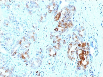 FTL / Ferritin Light Chain Antibody - IHC testing of FFPE human prostate with FTL antibody. Required HIER: boil tissue sections in 10mM citrate buffer, pH 6, for 10-20 min and allow to cool before testing.