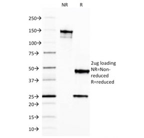 FTL / Ferritin Light Chain Antibody - SDS-PAGE analysis of purified, BSA-free FTL antibody as confirmation of integrity and purity.