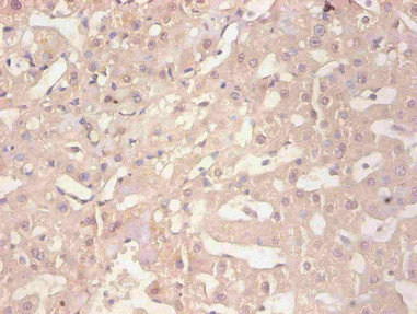 FTL / Ferritin Light Chain Antibody - Immunohistochemical of paraffin-embedded human liver tissue using FTL Monoclonal Antibody at dilution of 1:200
