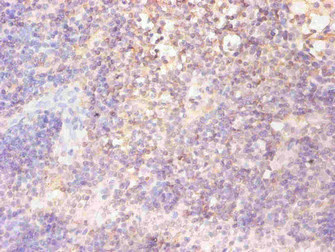 FTL / Ferritin Light Chain Antibody - Immunohistochemical of paraffin-embedded human lymph node tissue using FTL Monoclonal Antibody at dilution of 1:200