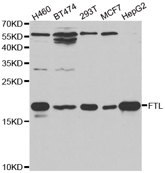 FTL / Ferritin Light Chain Antibody - Western blot analysis of extracts of various cell lines, using FTL antibody at 1:1000 dilution. The secondary antibody used was an HRP Goat Anti-Rabbit IgG (H+L) at 1:10000 dilution. Lysates were loaded 25ug per lane and 3% nonfat dry milk in TBST was used for blocking.