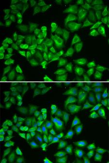 FTL / Ferritin Light Chain Antibody - Immunofluorescence analysis of A549 cells using FTL antibody. Blue: DAPI for nuclear staining.