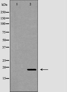 FTL / Ferritin Light Chain Antibody - Western blot analysis of mouse liver tissue lysates using FTL antibody. The lane on the left is treated with the antigen-specific peptide.