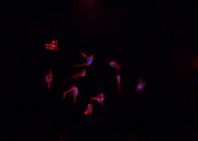 FTL / Ferritin Light Chain Antibody - Staining HepG2 cells by IF/ICC. The samples were fixed with PFA and permeabilized in 0.1% Triton X-100, then blocked in 10% serum for 45 min at 25°C. The primary antibody was diluted at 1:200 and incubated with the sample for 1 hour at 37°C. An Alexa Fluor 594 conjugated goat anti-rabbit IgG (H+L) antibody, diluted at 1/600, was used as secondary antibody.