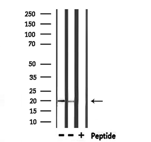 FTL / Ferritin Light Chain Antibody - Western blot analysis of extracts of mouse liver, rat liver tissue using FTL antibody.