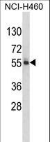 FTO Antibody - Western blot of FTO Antibody in NCI-H460 cell line lysates (35 ug/lane). FTO (arrow) was detected using the purified antibody.
