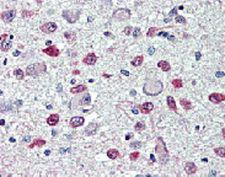 FTO Antibody - Immunohistochemical staining of FTO with anti-FTO (human), mAb (AG103) in brain, hypothalamus and paraventricular nucleus (5~10 ug/ml). This antibody has been tested in immunohistochemistry, analyzed by an anatomic pathologist and validated for use in IHC applications against formalin fixed, paraffin-embedded human tissues. The image shows the localization of the antibody as the precipitated red signal, with a hematoxylin purple nuclear counterstain (40x).