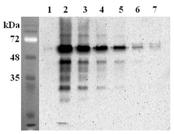FTO Antibody - Immunoprecipitation confirmed by recombinant mouse FTO. Recombinant mouse FTO proteins at different concentrations were precipitated using anti-FTO (mouse), mAb (FT62-6) . The precipitated proteins were separated by SDS-PAGE, electroblotted, and visualized by western blot with rabbit anti-mouse FTO pAb. 1. mFTO (His-tagged) recombinant control 50ng (AG-40A-127). 2. mFTO (His-tagged) 10 ug. 3. mFTO (His-tagged) 5 ug. 4. mFTO (His-tagged) 2.5 ug. 5. mFTO (His-tagged) 1.25 ug. 6. mFTO (His-tagged) 0.312 ug. 7. mFTO (His-tagged) 0.156 ug.