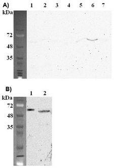 FTO Antibody - Western blot analysis using anti-FTO (mouse), mAb (FT62-6) at 1:2000 dilution. A). 1: Mouse kidney (200 ug). 2: Mouse spleen (200 ug). 3: Mouse heart (200 ug). 4: Mouse liver (500 ug). 5: Mouse stomach (200 ug). 6: Mouse brain (300 ug). 7: Mouse lung (200 ug). B). 1: Mouse FTO (10ng). 2: 3T3L1 (100 ug).