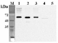 FTO Antibody - Western blot analysis using anti-FTO (human), mAb (FT86-4) at 1:2000 dilution. 1: Human FTO (His-tagged) (100 ng). 2: Mouse FTO (His-tagged) (100ng). 3: Rat FTO (His-tagged) (100 ng). 4: HEK 293 cell lysate (100 ug). 5: Human Calreticulin (His-tagged) (100ng) (negative control).