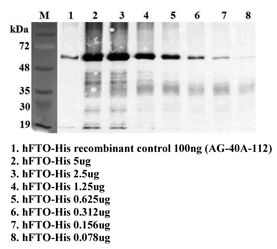 FTO Antibody - Immunoprecipitation of recombinant human FTO using anti-FTO (human), mAb (FT86-4). Recombinant human FTO proteins at different concentrations were precipitated by FT86-4. The precipitated proteins were separated by SDS-PAGE, electroblotted, and visualized by western blot with rabbit anti-mouse FTO pAb.