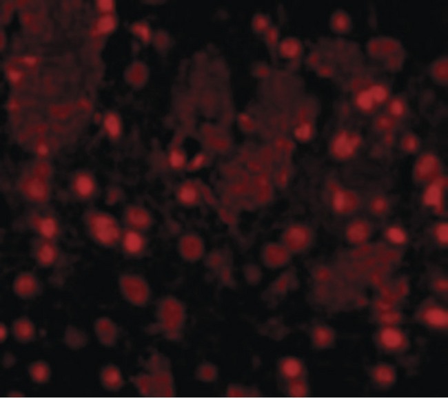 FTO Antibody - Immunofluorescence of FTO in Mouse Brain cells with FTO antibody at 20 ug/ml.