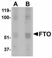 FTO Antibody - Western blot of FTO in human uterus tissue lysate with FTO antibody at (A) 1 and (B) 2 ug/ml. Below: Immunohistochemistry of FTO in mouse brain tissue with FTO antibody at 2.5 ug/ml.