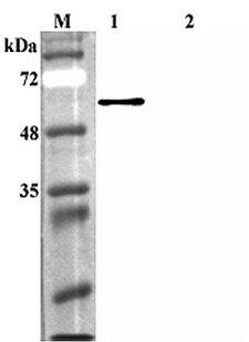 FTO Antibody - Western blot analysis using anti-FTO (human), pAb at 1:4000 dilution. 1: Human FTO (His-tagged). 2: Human Sirtuin 1 (His-tagged) (negative control).