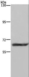 FTO Antibody - Western blot analysis of Human fetal brain tissue, using FTO Polyclonal Antibody at dilution of 1:650.
