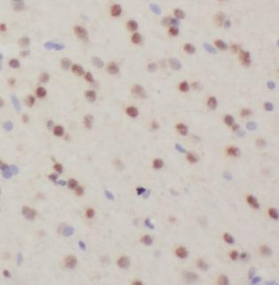 FTO Antibody - Immunohistochemistry of paraffin-embedded mouse brain tissue slide using FTO antibody at dilution of 1:400