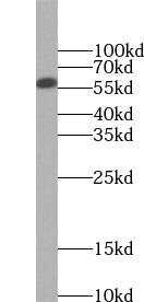 FTO Antibody - Mouse brain tissue were subjected to SDS PAGE followed by western blot with FTO antibody at dilution of 1:300