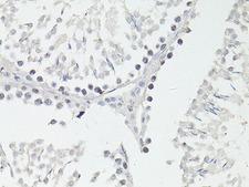 FTO Antibody - Immunohistochemistry of paraffin-embedded Rat testis using FTO Polyclonal Antibody at dilution of 1:100 (40x lens).