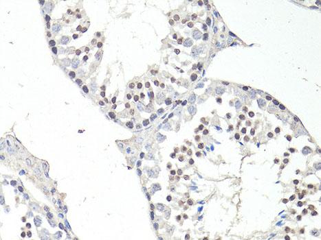 FTO Antibody - Immunohistochemistry of paraffin-embedded Mouse testis using FTO Polyclonal Antibody at dilution of 1:100 (40x lens).