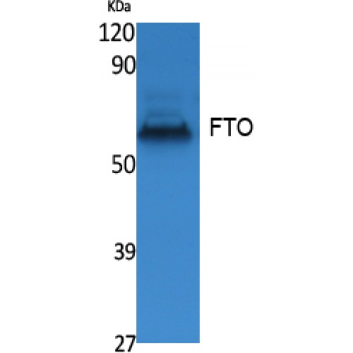 FTO Antibody - Western blot of FTO antibody