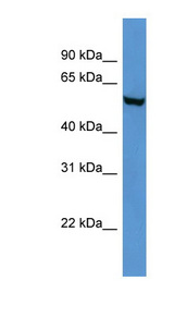 FTO Antibody - FTO antibody Western blot of Mouse Brain lysate. This image was taken for the unconjugated form of this product. Other forms have not been tested.