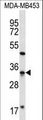 FTSJ1 Antibody - FTSJ1 Antibody western blot of MDA-MB453 cell line lysates (35 ug/lane). The FTSJ1 antibody detected the FTSJ1 protein (arrow).