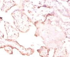 FTSJ1 Antibody - Immunohistochemistry of paraffin-embedded human placenta tissue using FTSJ1 Antibody at dilution of 1:50