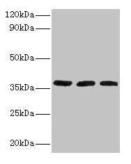 FTSJ1 Antibody - Western blot All lanes: Putative tRNAcytidine (32) /guanosine (34) -2'-O) -methyltransferase antibody at 2µg/ml Lane 1: HepG2 whole cell lysate Lane 2: Mouse brain tissue Lane 3: EC109 whole cell lysate Secondary Goat polyclonal to rabbit IgG at 1/15000 dilution Predicted band size: 37, 36 kDa Observed band size: 16.7 kDa
