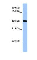 FTSJ1 Antibody - HepG2 cell lysate. Antibody concentration: 1.0 ug/ml. Gel concentration: 12%.  This image was taken for the unconjugated form of this product. Other forms have not been tested.
