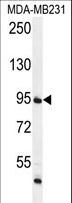 FTSJ3 Antibody - FTSJ3 Antibody western blot of MDA-MB231 cell line lysates (35 ug/lane). The FTSJ3 antibody detected the FTSJ3 protein (arrow).