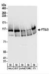 FTSJ3 Antibody - Detection of Human and Mouse FTSJ3 by Western Blot. Samples: Whole cell lysate (50 ug) from HeLa, 293T, Jurkat, mouse TCMK-1, and mouse NIH3T3 cells. Antibodies: Affinity purified rabbit anti-FTSJ3 antibody used for WB at 0.04 ug/ml. Detection: Chemiluminescence with an exposure time of 10 seconds.