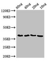 FtsZ Antibody - Western Blot Positive WB detected in Recombinant protein All Lanes:ftsZ antibody at 3.5µg/ml Secondary Goat polyclonal to rabbit IgG at 1/50000 dilution Predicted band size: 39 kDa Observed band size: 39 kDa