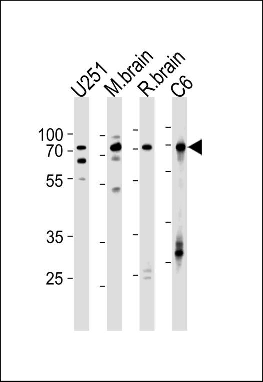 FUBP1 Antibody - FUBP1 Antibody western blot of U251,rat C6 cell line,mouse brain,rat brain tissue lysates (35 ug/lane). The FUBP1 antibody detected the FUBP1 protein (arrow).