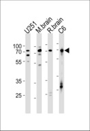 FUBP1 Antibody - FUBP1 Antibody western blot of U251,rat C6 cell line,mouse brain,rat brain tissue lysates (35 ug/lane). The FUBP1 antibody detected the FUBP1 protein (arrow).