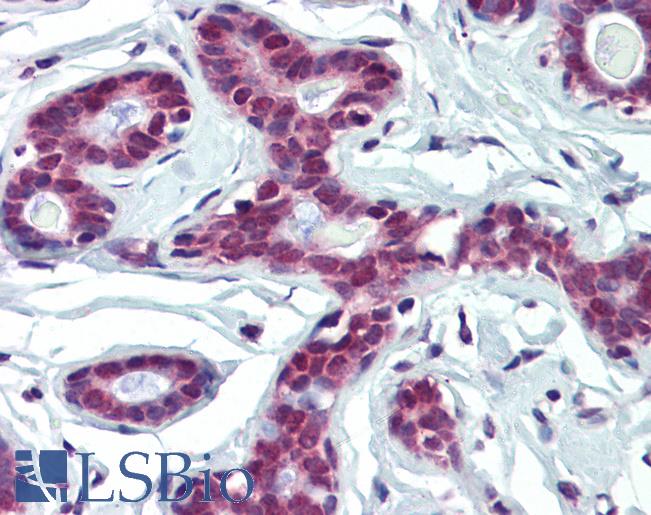 FUBP1 Antibody - Anti-FUBP1 antibody IHC of human breast. Immunohistochemistry of formalin-fixed, paraffin-embedded tissue after heat-induced antigen retrieval. Antibody concentration 5 ug/ml.  This image was taken for the unconjugated form of this product. Other forms have not been tested.
