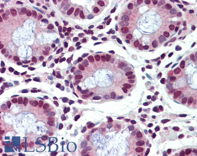 FUBP1 Antibody - Anti-FUBP1 antibody IHC of human colon. Immunohistochemistry of formalin-fixed, paraffin-embedded tissue after heat-induced antigen retrieval. Antibody concentration 5 ug/ml.  This image was taken for the unconjugated form of this product. Other forms have not been tested.
