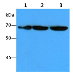 FUBP1 Antibody - The Cell lysates (40ug) were resolved by SDS-PAGE, transferred to PVDF membrane and probed with anti-human FUBP1 antibody (1:1000). Proteins were visualized using a goat anti-mouse secondary antibody conjugated to HRP and an ECL detection system. Lane 1.: HeLa cell lysate Lane 2.: HepG2 cell lysate Lane 3.: Jurkat cell lysate